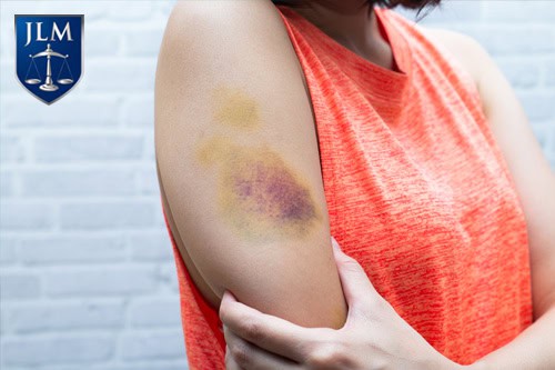 john l michels pc 273 5 understanding penal code charges california